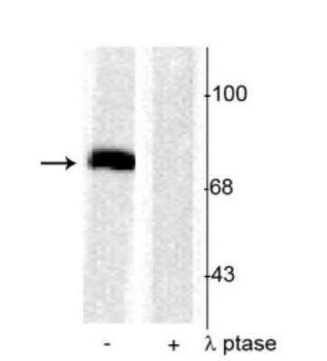 Western Blot: Synapsin I [p Ser603] Antibody [NB300-181] - Rat cortical lysate showing specific immunolabeling of the ~78 kDa synapsin I phosphorylated at Ser603 in the first lane (-). Phosphospecificity is shown in thesecond lane (+) where the immunolabeling is completely eliminated by blot treatment with lambda phosphatase (l-Ptase, 1200 units for 30 minutes).